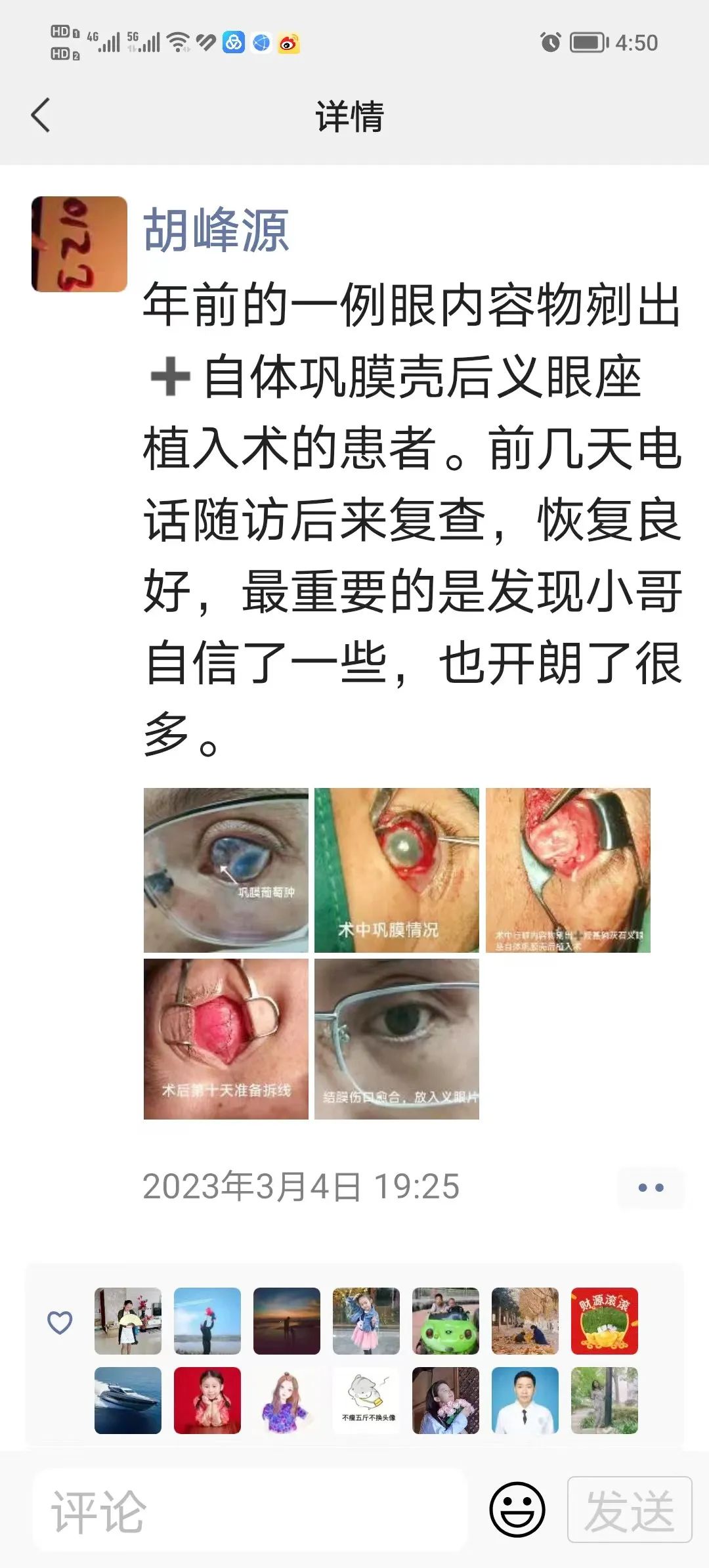 隆回县人民医院：眼科美容手术，还患者自信