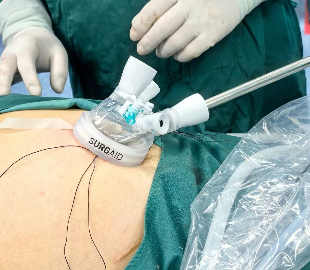 拒绝手术留疤焦虑，年轻人就医也能 “颜值在线”~